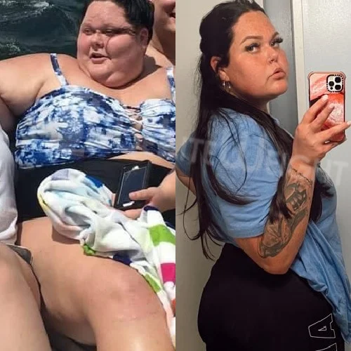 Stacy L - 1 Year Update*